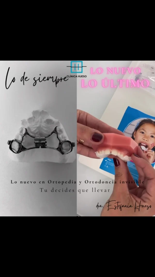 Bueno bueno… os traemos las últimas novedades en tratamiento de ORTOPEDIA EN NIÑOS - los peques de la casa!! 

Invisalign Palatal Expander 🦷✨
¿Sabes qué es el nuevo expansor? 🤔 Es un dispositivo ortodóntico innovador que combina la tecnología de Invisalign con la expansión del paladar. ¡Es cómodo, discreto y personalizado! 😊

Características clave:
	•	Cómodo: Diseño suave que reduce irritaciones 🌟
	•	Discreto: Transparente y casi invisible, ideal para tratamientos sin llamar la atención 🙅‍♂️
	•	Personalizado: Se ajusta a cada paciente gracias a escaneos digitales 📊
	•	Removible: Fácil de limpiar y usar durante comidas 🍴

¿Cómo funciona?
	1.	Consulta inicial: Escaneos digitales para un modelo 3D de tu boca 📸
	2.	Expansión progresiva: Usas una serie de expanders removibles que ensanchan gradualmente el paladar 🔄
	3.	Estabilización y alineación: Una vez expandido, los alineadores ajustan la posición de los dientes para una sonrisa perfecta 💫

¡Ideal para aquellos que buscan una solución moderna y estética! 😁 

Consúltanos y te daremos cita con nuestra ortodoncista para más información. ¡Tu peque merece lo mejor! 💖

#kids #ortodoncia #ortopedia #niños #ortodonciainvisible